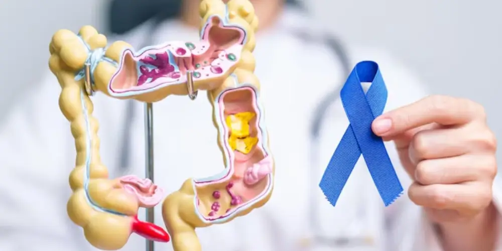 Gastrointestinal cancer awareness for women