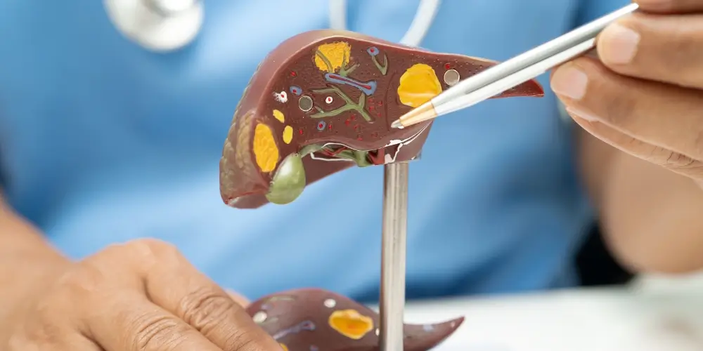 Liver cancer awareness for women