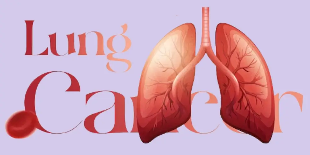 Lung cancer awareness for women